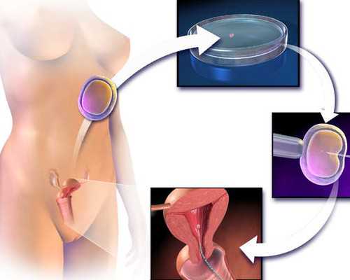 南京去哪里找代怀,南京妇幼保健院做三代试管费用详解