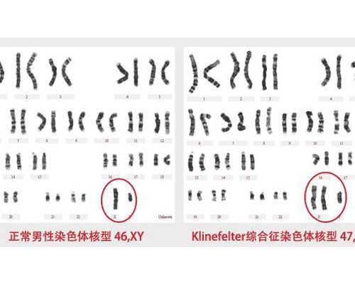 江苏私人试管婴儿医院安全吗？,江苏试管婴儿纳入医保吗