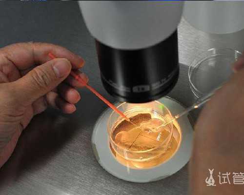 苏州代生哪里便宜,北京供卵试管机构有哪些_苏州亲子鉴定在哪里做,费用是多少