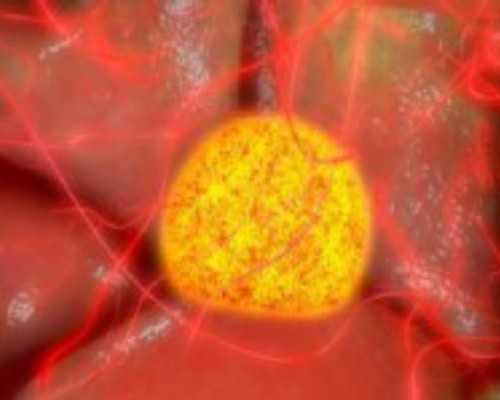 南京代孕哪家有保障,做试管婴儿移植后停药就能来月经吗，以前月经几个月才